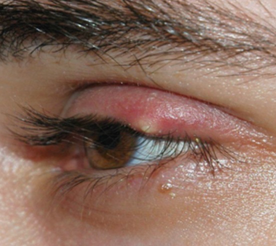 eyelash extensions stye