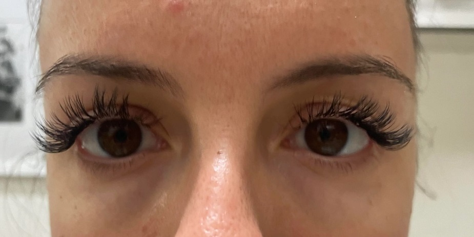 itchy eyelash extensions